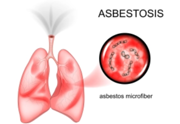 microfibras-asbestos